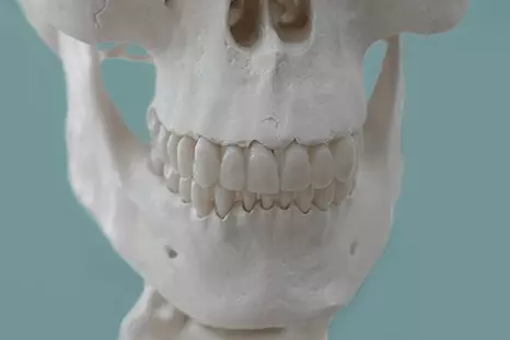 Компьютерная томография челюстно-лицевой области